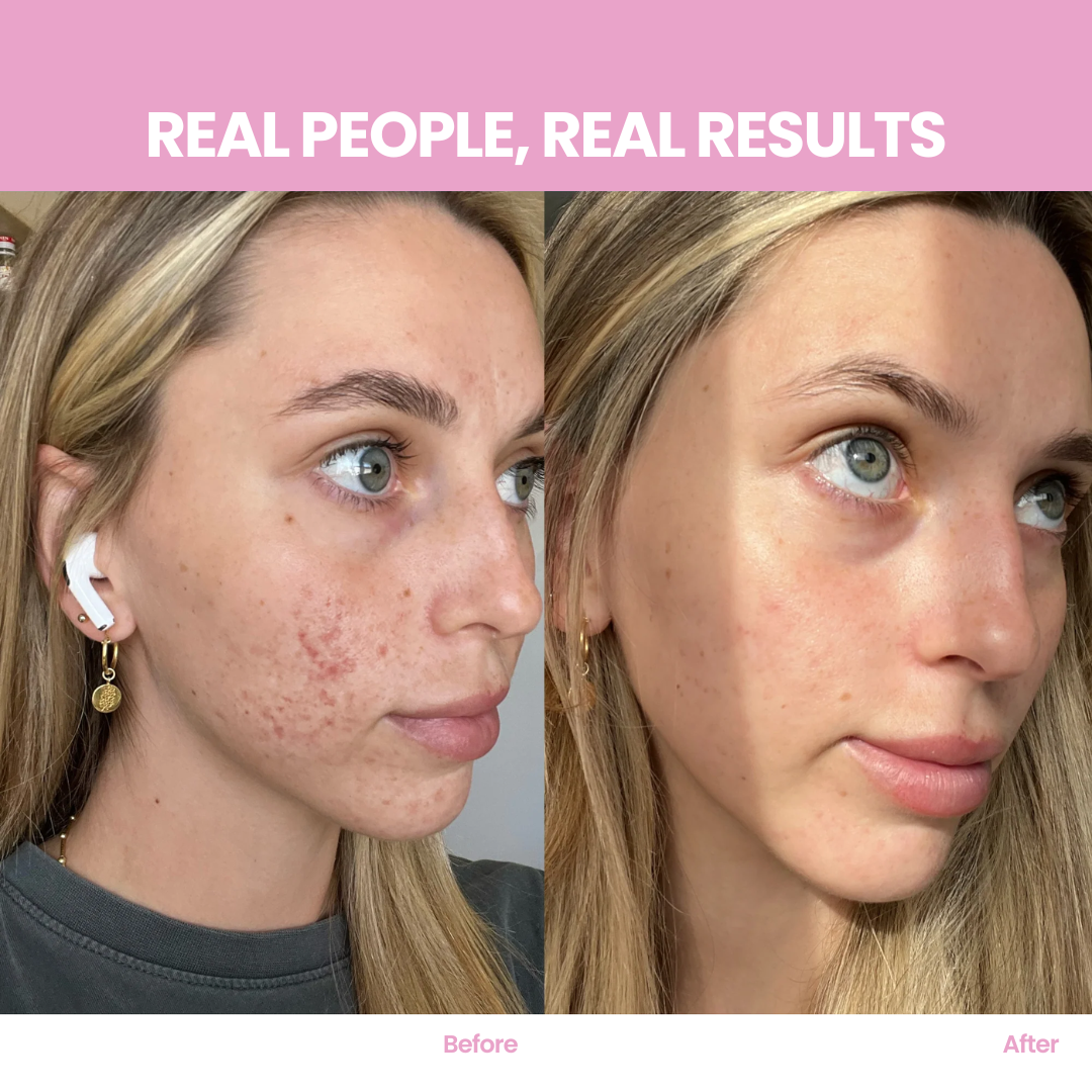 Multi-Collagen Peptides Powder