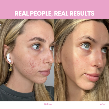 Multi-Collagen Peptides Powder